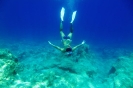 Apnea